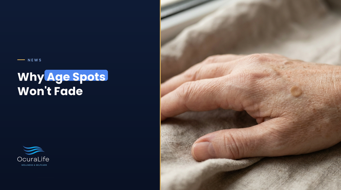 An older hand resting on linen in natural light with one flat light-brown age spot