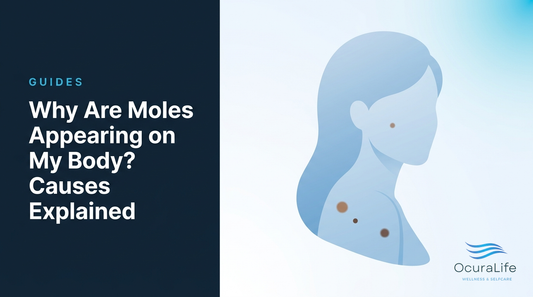 Editorial illustration: Why Are Moles Appearing on My Body? Causes Explained