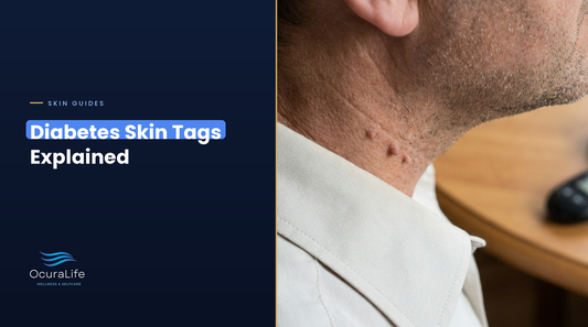 Close-up of several small skin tags on the side of a man's neck above a shirt collar