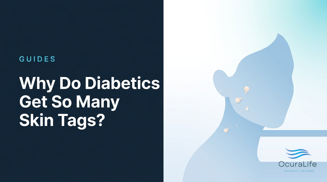 Why Do Diabetics Get So Many Skin Tags? - OcuraLife