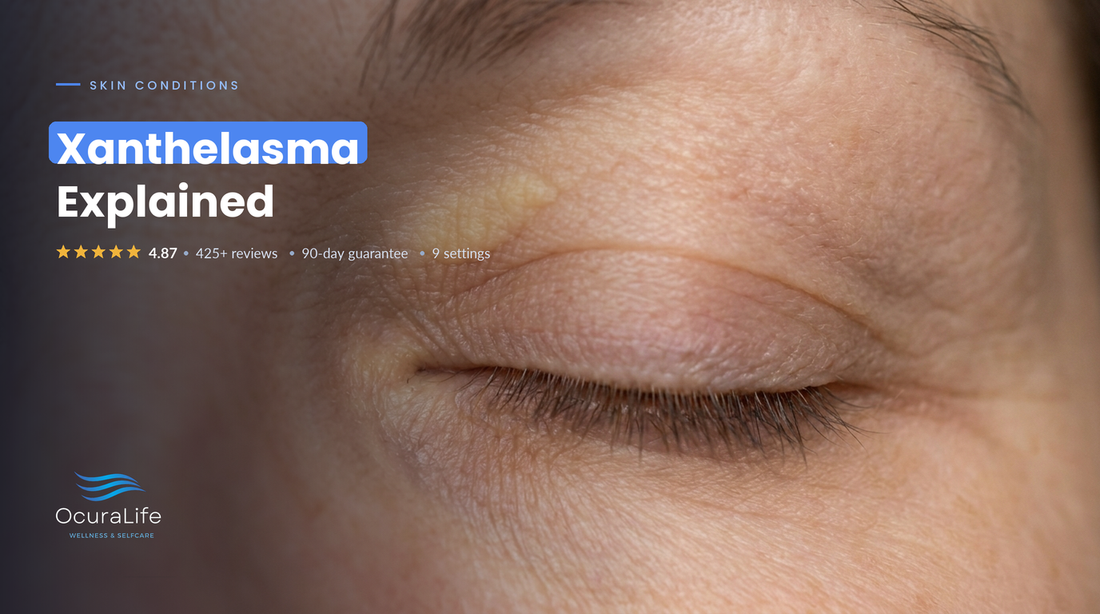 Close-up of a closed eye with a flat, pale yellow xanthelasma cholesterol deposit on the upper eyelid near the inner corner