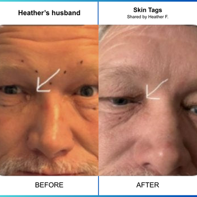Eye Tag