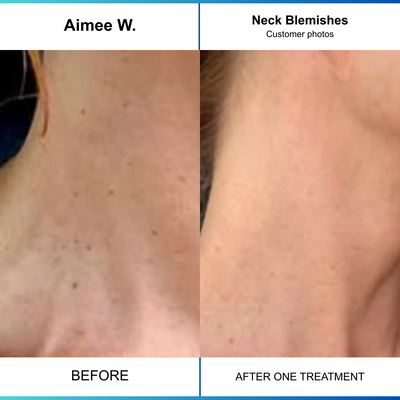 Neck
