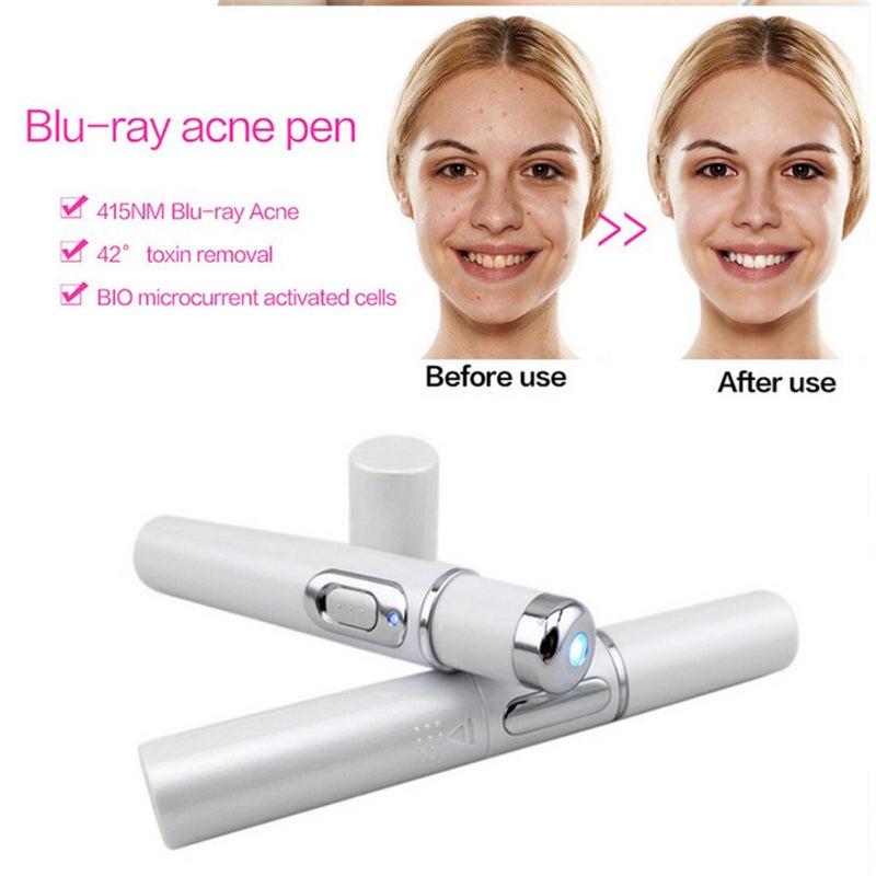 Blue Light Acne Remover Pen