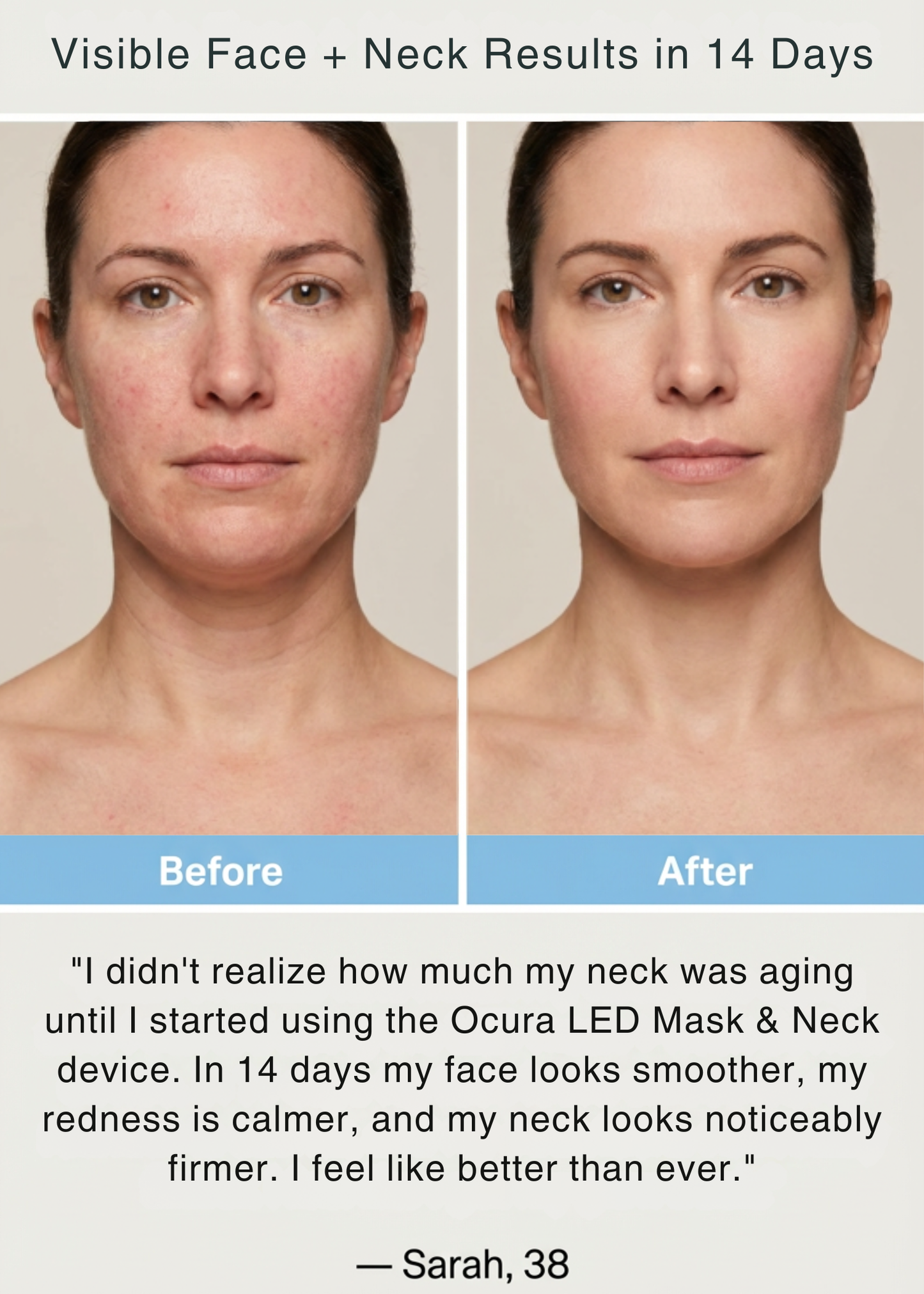 LED Skin Rejuvenation Mask & Neck