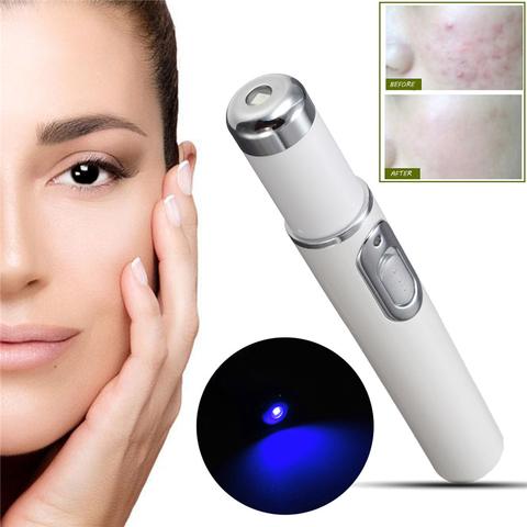 Blue Light Acne Remover Pen