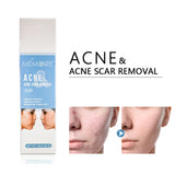 Facial Repair And Lightening Acne Print Herbal Acne Cream