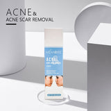 Facial Repair And Lightening Acne Print Herbal Acne Cream