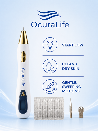 Ocura professional grade needle set for precise blemish removal at home