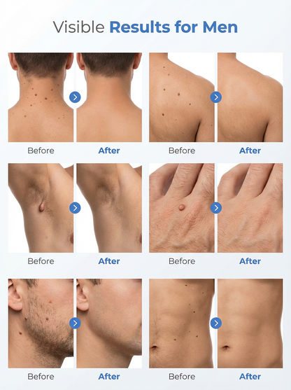 6-in-1 Blemish Correction Pen