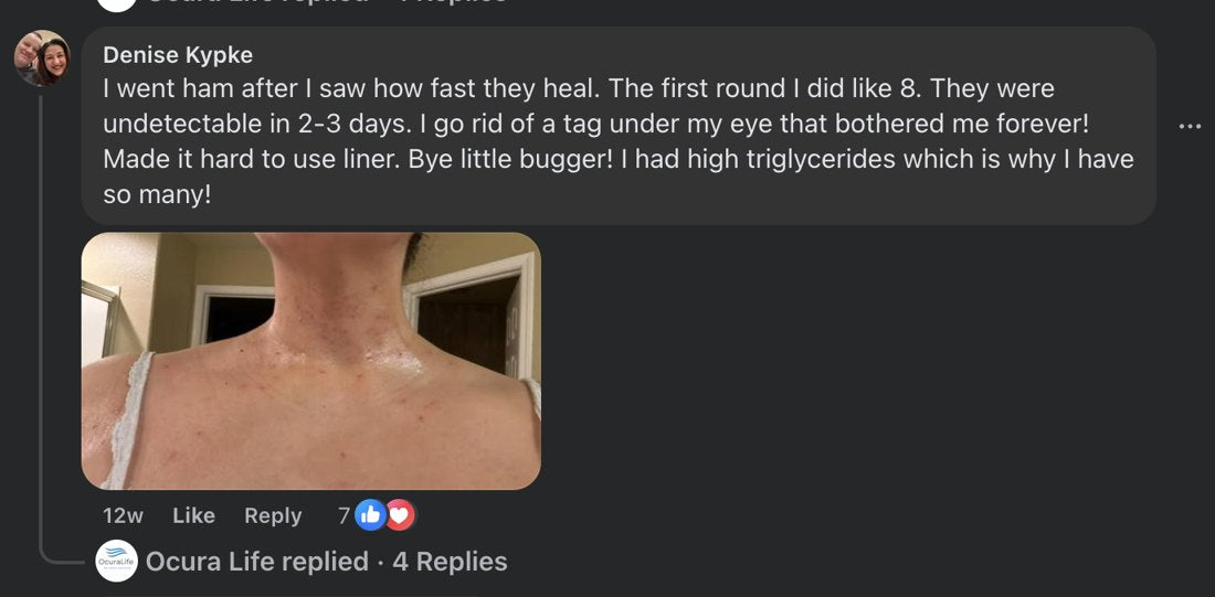 Denise Kypke, Facebook comment