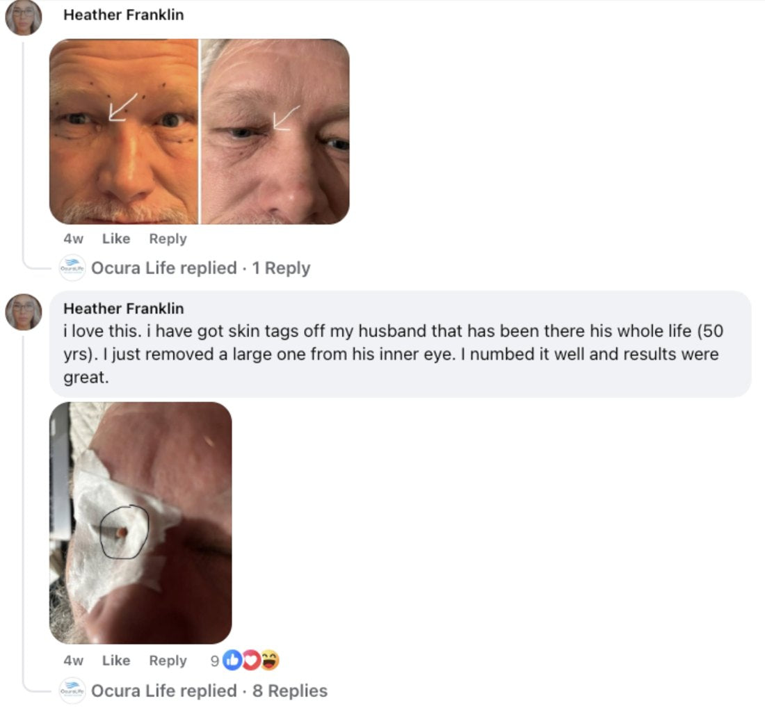Heather Franklin, Facebook comment with before and after photos