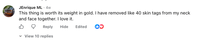 JEnrique, verified Facebook comment about removing 40 skin tags