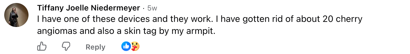 Tiffany Joelle Niedermeyer, Facebook comment about removing about 20 cherry angiomas and a skin tag