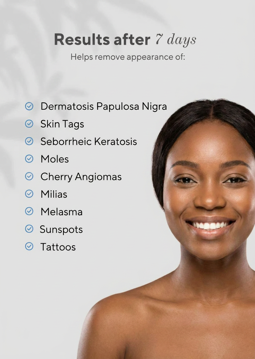 OcuraLife plasma pen for dermatosis papulosa nigra at home