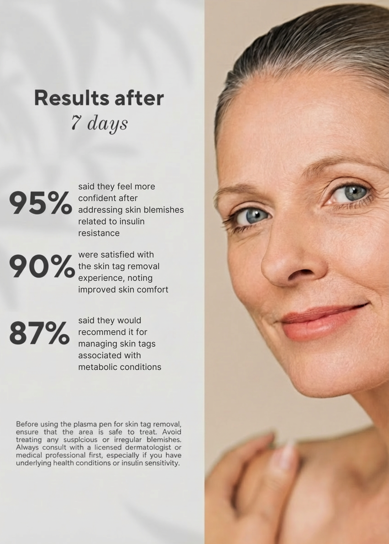 GlucoDerm 6-in-1 plasma correction pen for at-home spot treatment