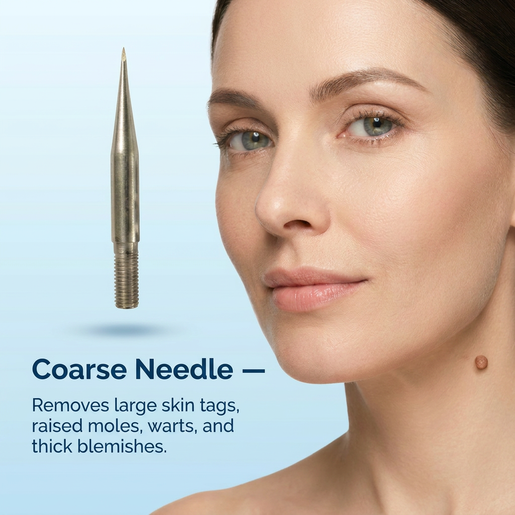 Ocura advanced needle kit for skin tag, milia and dark spot removal