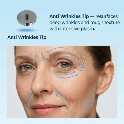 Ocura plasma pen replacement needles for continued treatments