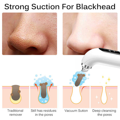 Clear Visage Hydro Blackhead Remover